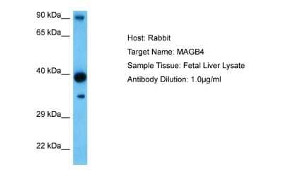 Western Blot: MAGEB4 Antibody [NBP2-83172]