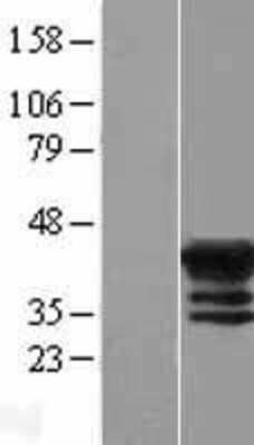 Western Blot: MAGEB4 Overexpression Lysate [NBL1-12811]