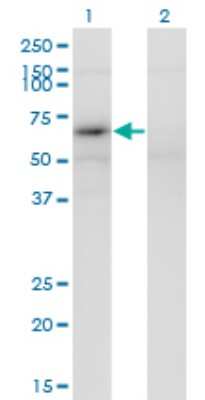 Western Blot: MAGEB6 Antibody (2C11) [H00158809-M02]