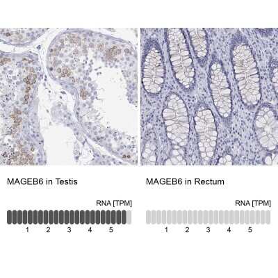 Immunocytochemistry/ Immunofluorescence: MAGEB6 Antibody [NBP3-17082]