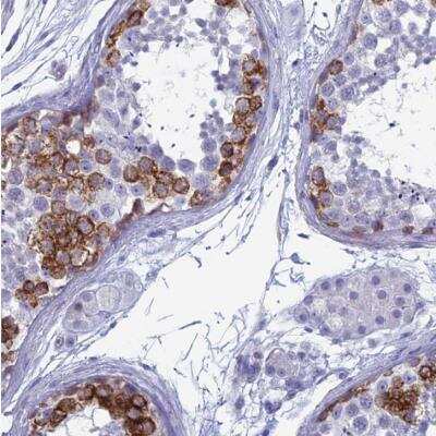 Immunohistochemistry-Paraffin: MAGEB6 Antibody [NBP1-84353]