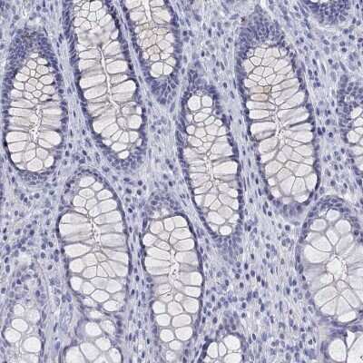 Immunohistochemistry-Paraffin: MAGEB6 Antibody [NBP3-17082]