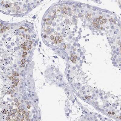 Immunohistochemistry-Paraffin: MAGEB6 Antibody [NBP3-17082]