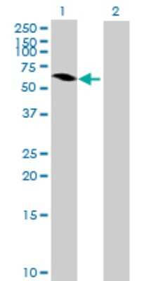 Western Blot: MAGEB6 Antibody [H00158809-B01P]