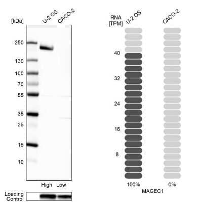 Western Blot: MAGEC1 Antibody [NBP1-85397]