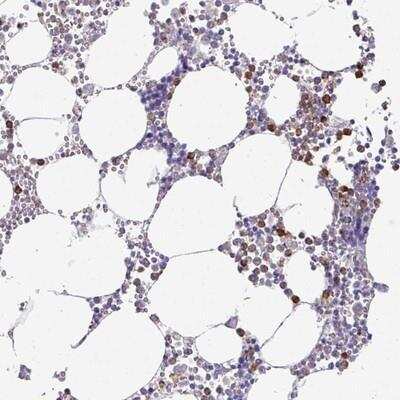 Immunohistochemistry-Paraffin: MAGEC3 Antibody [NBP2-14757]