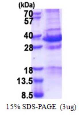 SDS-PAGE: Recombinant Human NRAGE/MAGED1 His Protein [NBP2-23226]