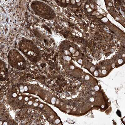 Immunohistochemistry-Paraffin: MAGED2 Antibody [NBP1-89412]