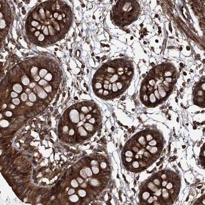Immunohistochemistry-Paraffin: MAGED2 Antibody [NBP1-89413]