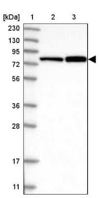 Western Blot: MAGED2 Antibody [NBP1-89412]