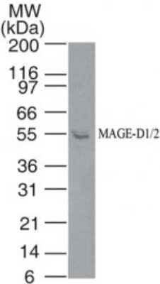 Western Blot: MAGED2 Antibody [NBP2-24694]