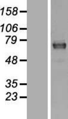 Western Blot: MAGED2 Overexpression Lysate [NBL1-12816]