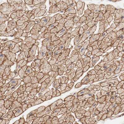 Immunohistochemistry-Paraffin: MAGED4B Antibody [NBP1-89594]