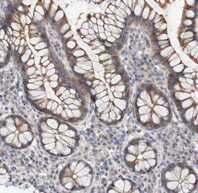Immunohistochemistry-Paraffin: MAGEE2 Antibody [NBP1-81764]