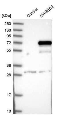 Western Blot: MAGEE2 Antibody [NBP1-81764]