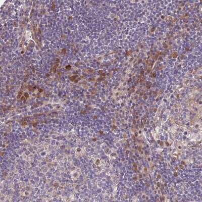 Immunohistochemistry: MAGEF1 Antibody [NBP2-47386]
