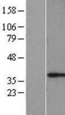 Western Blot: MAGEF1 Overexpression Lysate [NBL1-12820]