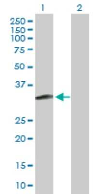 Western Blot: MAGEH1 Antibody [H00028986-D01P]