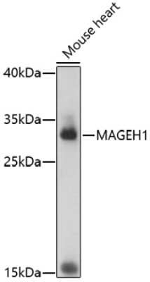 Western Blot: MAGEH1 AntibodyAzide and BSA Free [NBP3-04393]