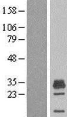 Western Blot: MAGEH1 Overexpression Lysate [NBL1-12821]