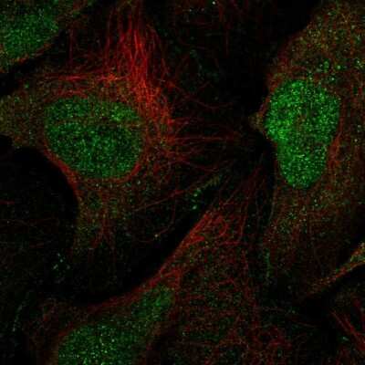 Immunocytochemistry/ Immunofluorescence: MAGI1 Antibody [NBP2-58071]