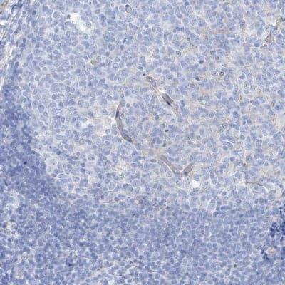 Immunohistochemistry-Paraffin: MAGI1 Antibody [NBP1-89182]