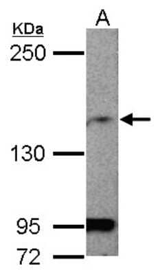 Western Blot: MAGI1 Antibody [NBP2-17209]