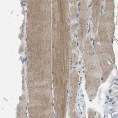 Immunohistochemistry-Paraffin: MAGI2 Antibody [NBP1-89261]