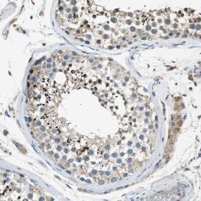 Immunohistochemistry-Paraffin: MAGI2 Antibody [NBP1-89261]