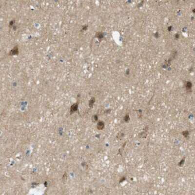 Immunohistochemistry-Paraffin: MAGI2 Antibody [NBP1-89261]