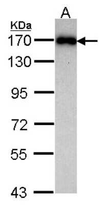 Western Blot: MAGI2 Antibody [NBP1-31015]