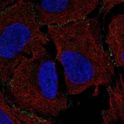 Immunocytochemistry/ Immunofluorescence: MAGI3 Antibody [NBP2-58916]