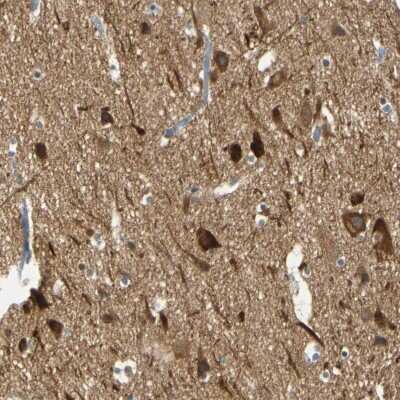 Immunohistochemistry-Paraffin: MAGI3 Antibody [NBP1-81266]