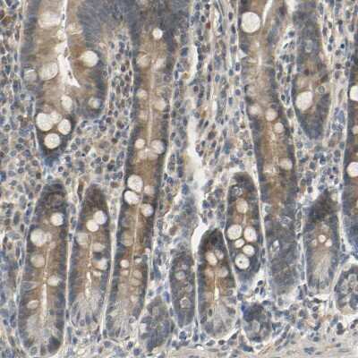 Immunohistochemistry-Paraffin: MAGI3 Antibody [NBP1-81266]