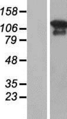 Western Blot: MAGI3 Overexpression Lysate [NBP2-05304]