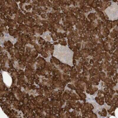 Immunohistochemistry-Paraffin: MAGIX Antibody [NBP1-93951]