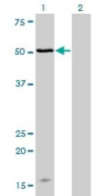 Western Blot: MAGOH Antibody (4H8) [H00004116-M02]