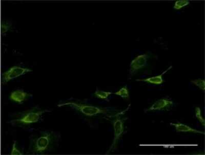 Immunocytochemistry/ Immunofluorescence: MAGOH Antibody (6E11) [H00004116-M01]