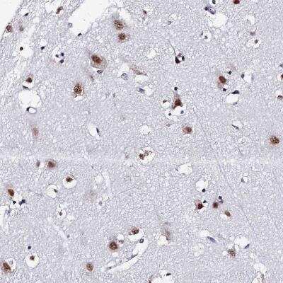Immunohistochemistry: MAGOH Antibody [NBP2-46689]