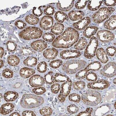 Immunohistochemistry: MAGOH Antibody [NBP2-46752]