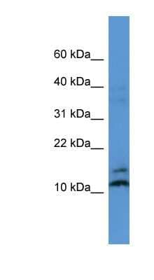 Western Blot: MAGOH Antibody [NBP1-79807]