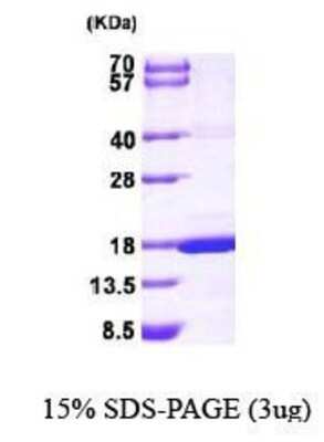 SDS-PAGE: Recombinant Human MAGOH His Protein [NBP1-44496]