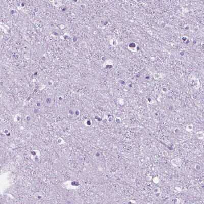Immunohistochemistry-Paraffin: MAGP-1/MFAP2 Antibody [NBP1-87735]