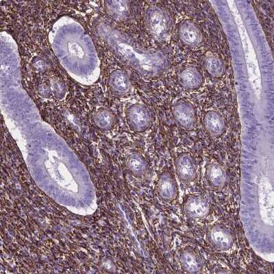 Immunohistochemistry-Paraffin: MAGP-1/MFAP2 Antibody [NBP1-87735]