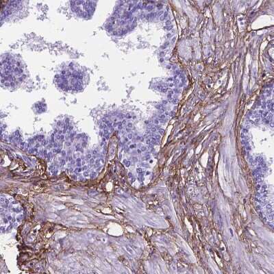 Immunohistochemistry-Paraffin: MAGP-1/MFAP2 Antibody [NBP1-87735]