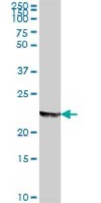 Western Blot: MAGP-1/MFAP2 Antibody [H00004237-B01P]