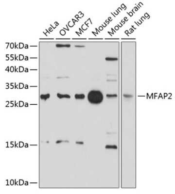 Western Blot: MAGP-1/MFAP2 AntibodyBSA Free [NBP3-03532]