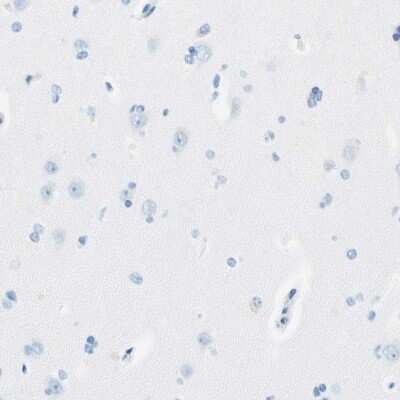 Immunohistochemistry-Paraffin: MAGP-2/MFAP5 Antibody [NBP1-82803]