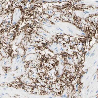 Immunohistochemistry-Paraffin: MAGP-2/MFAP5 Antibody [NBP1-82803]