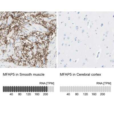 Immunohistochemistry-Paraffin: MAGP-2/MFAP5 Antibody [NBP1-82803]